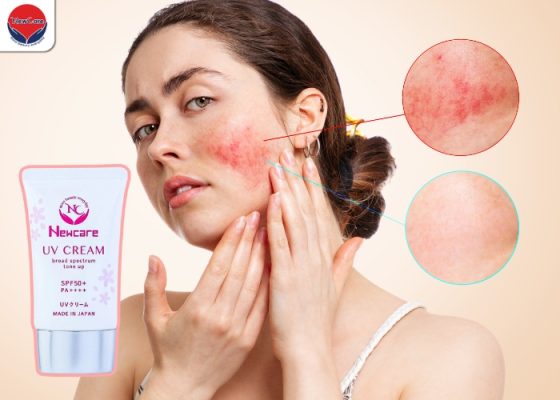 Tiêu chuẩn lựa chọn kem chống nắng để không bị nóng mặt