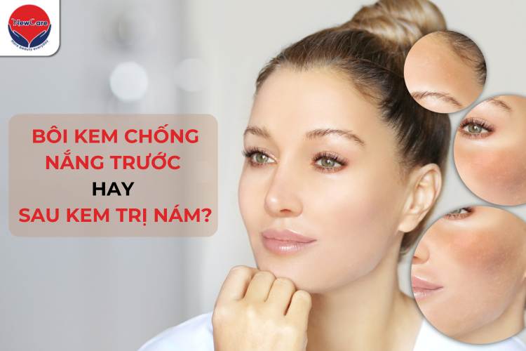 Nên bôi kem chống nắng trước hay sau kem trị nám để nâng cao hiệu quả trị nám?