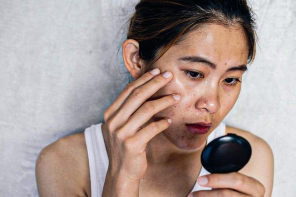 Dùng kem chống nắng vẫn bị đen da