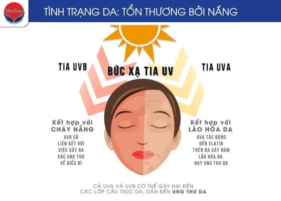 Tia UVA có thể xuyên qua mây và cửa sổ
