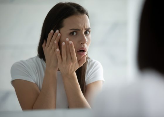 Bôi kem chống nắng bị xuống tone