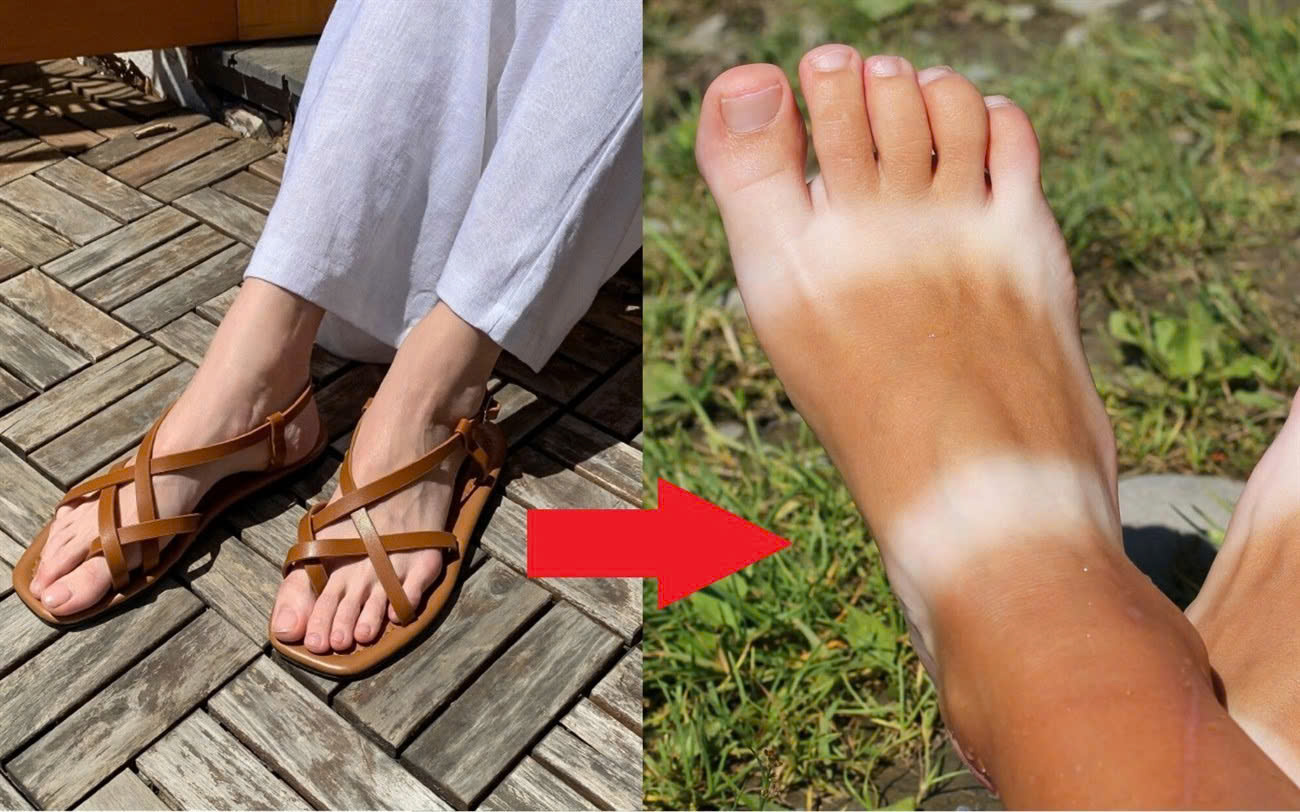 Bí kíp dưỡng trắng da tay và chân bị “hai màu” sau khi mặc áo ngắn tay.